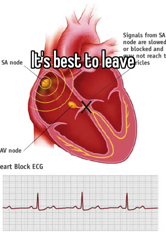 it-s-best-to-leave