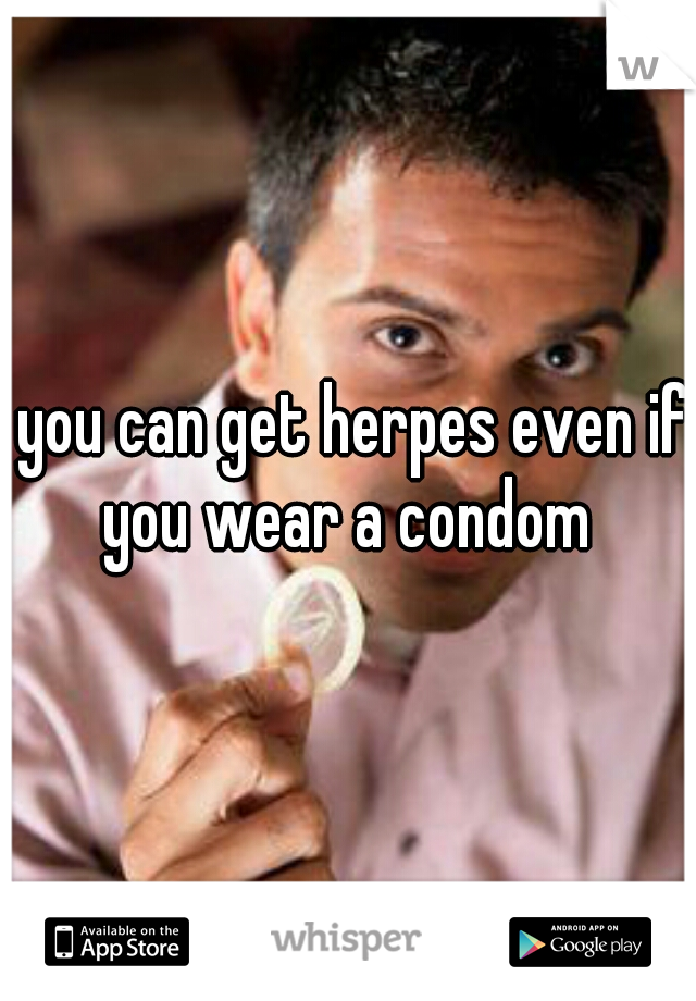 you can get herpes even if you wear a condom 