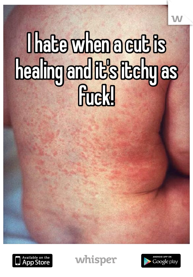 I hate when a cut is healing and it's itchy as fuck!