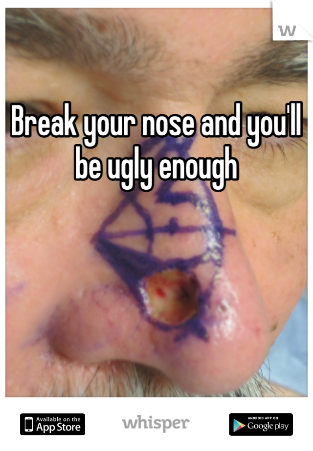 Break your nose and you'll be ugly enough