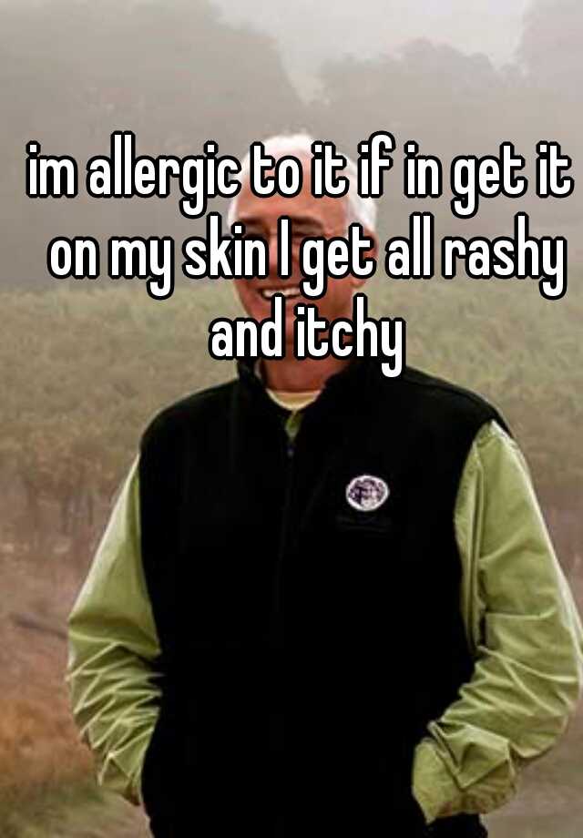 im-allergic-to-it-if-in-get-it-on-my-skin-i-get-all-rashy-and-itchy