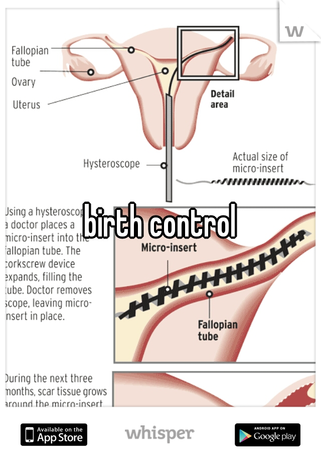 birth control