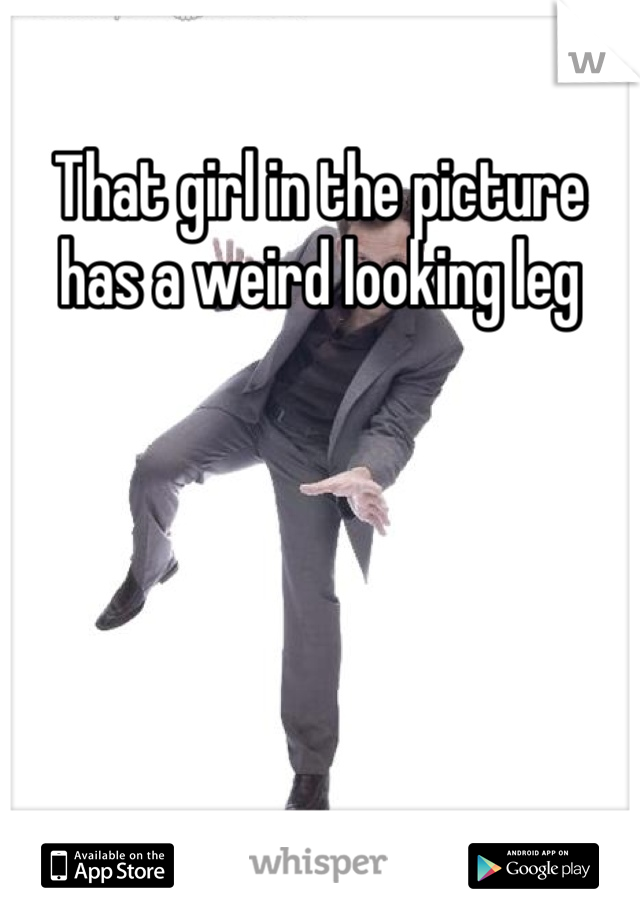 That girl in the picture has a weird looking leg 