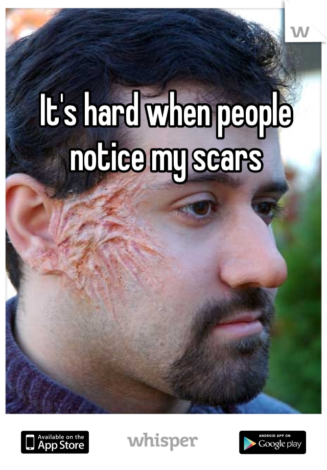 It's hard when people notice my scars 