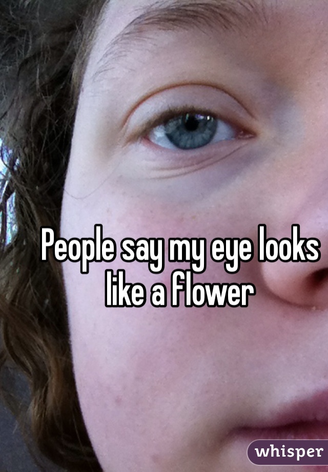 People say my eye looks like a flower