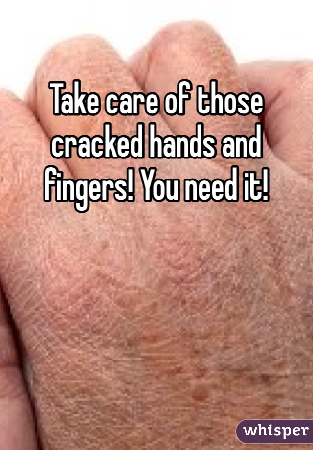 Take care of those cracked hands and fingers! You need it!
