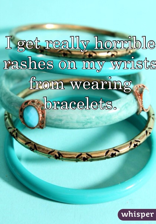 I get really horrible rashes on my wrists from wearing bracelets. 