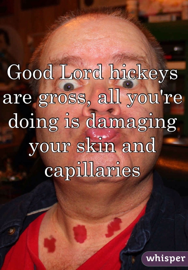 Good Lord hickeys are gross, all you're doing is damaging your skin and capillaries 