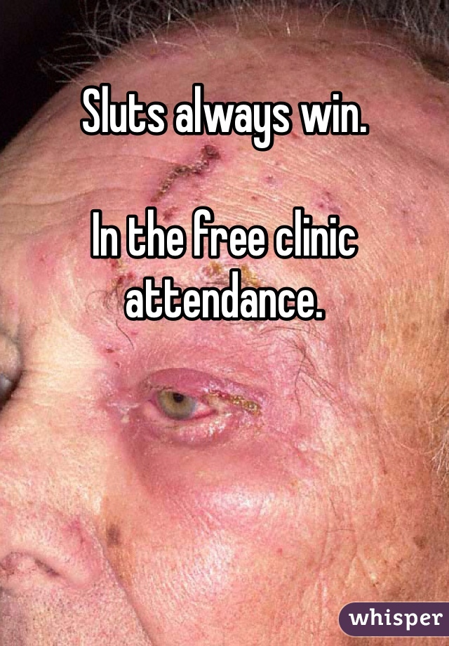 Sluts always win. 

In the free clinic attendance. 