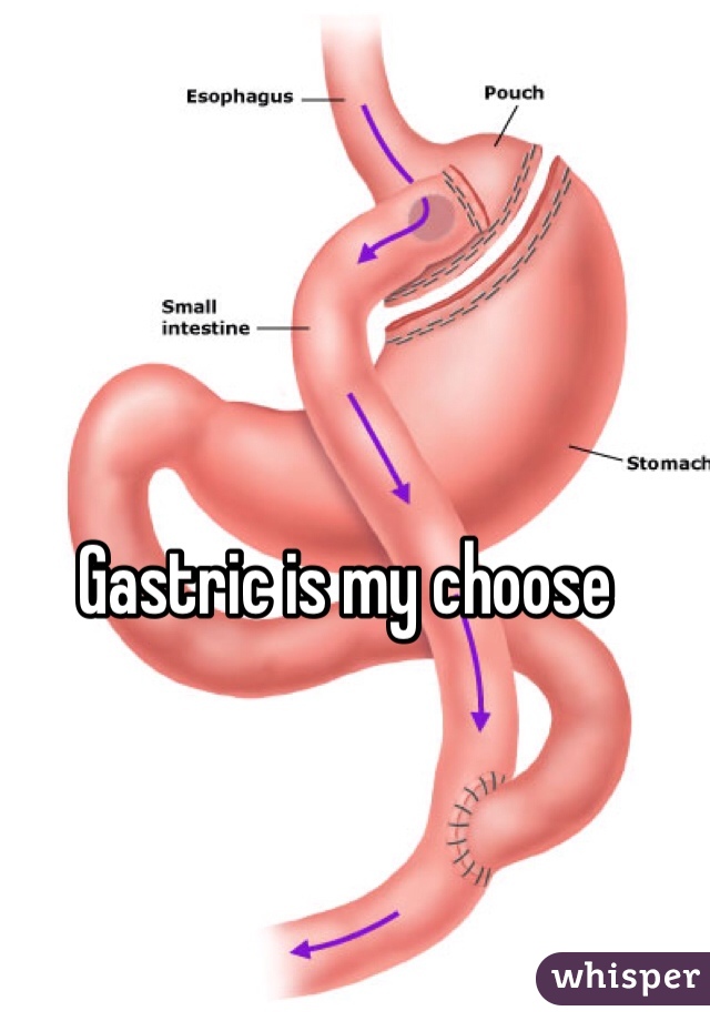 Gastric is my choose 