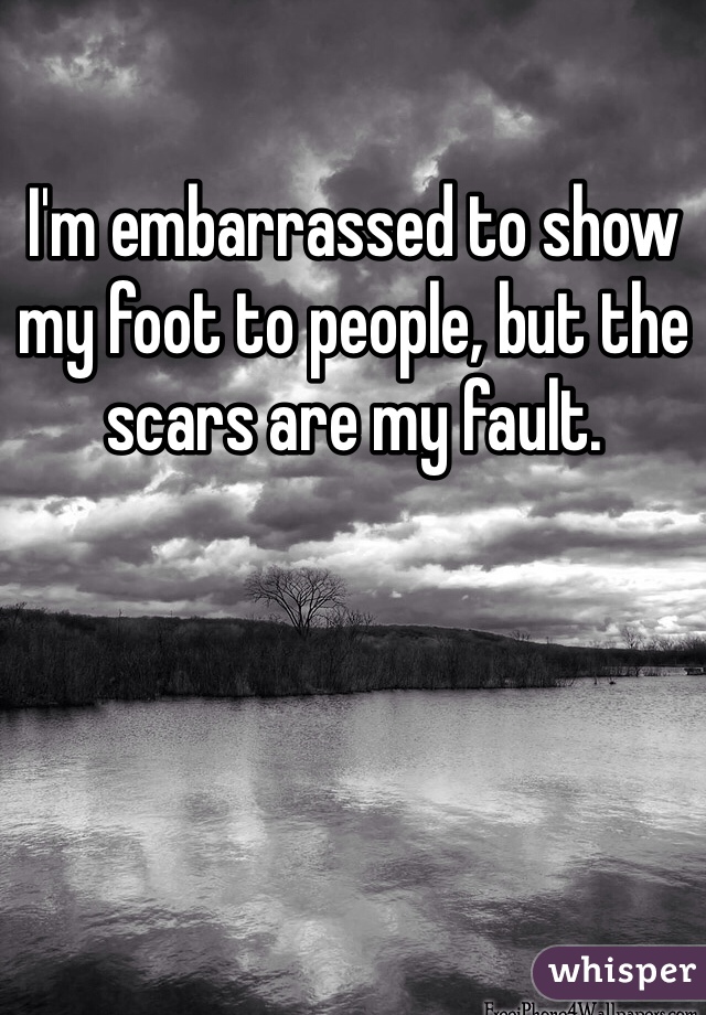 I'm embarrassed to show my foot to people, but the scars are my fault.