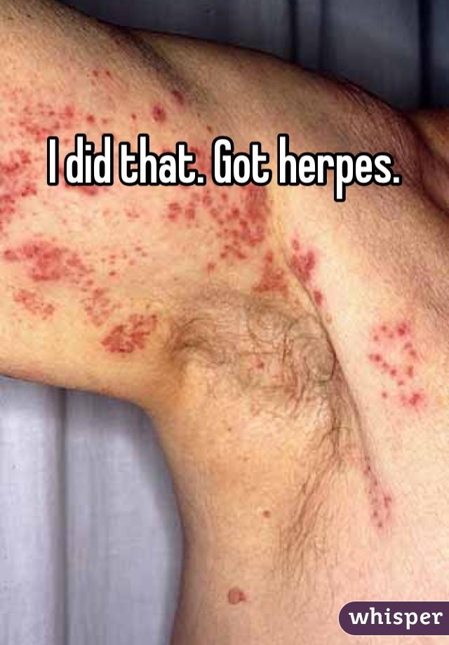 I did that. Got herpes. 