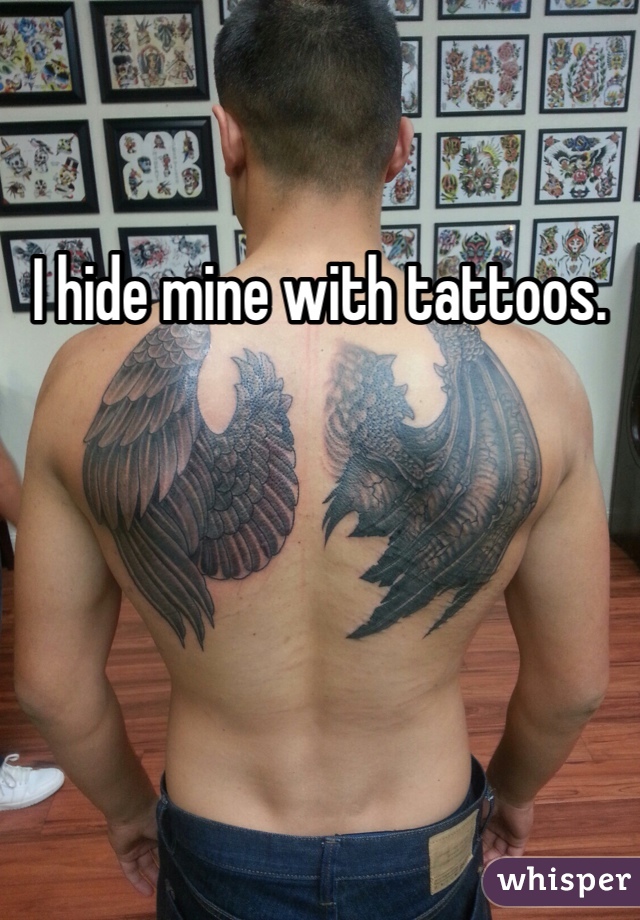 I hide mine with tattoos.