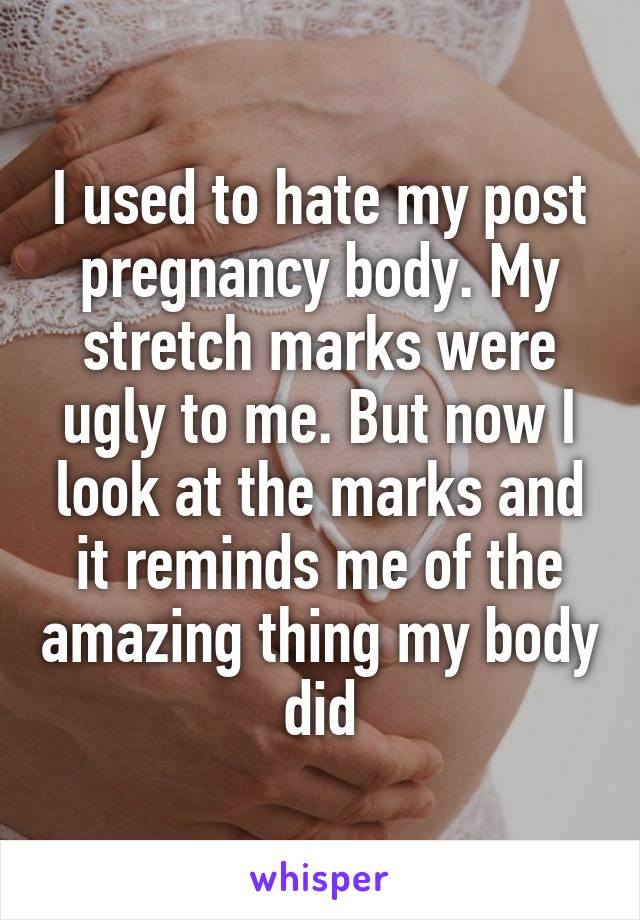 I used to hate my post pregnancy body. My stretch marks were ugly to me. But now I look at the marks and it reminds me of the amazing thing my body did
