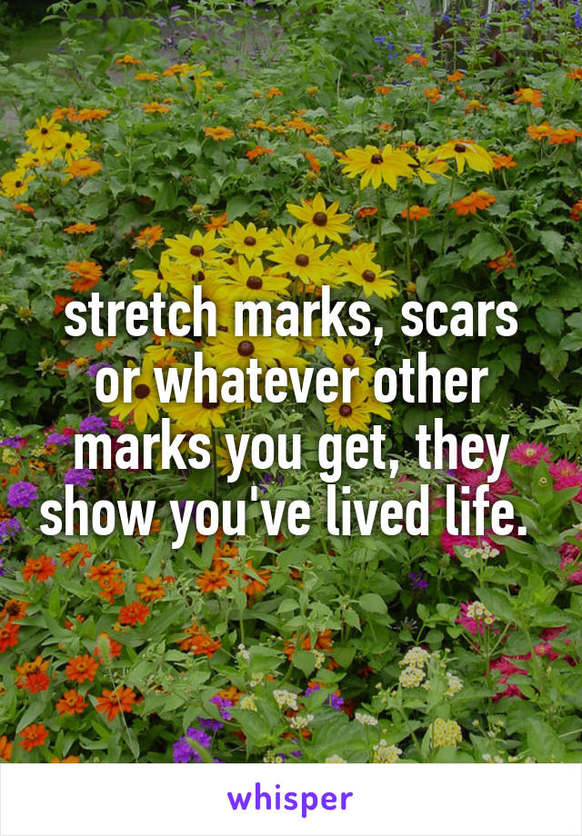 stretch marks, scars or whatever other marks you get, they show you've lived life. 