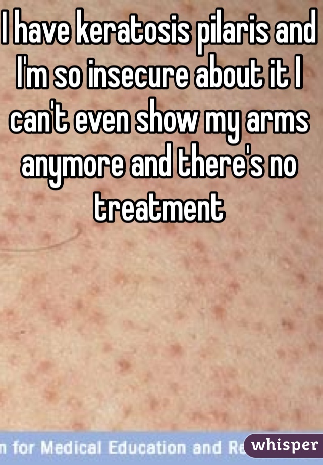 I have keratosis pilaris and I'm so insecure about it I can't even show my arms anymore and there's no treatment 
