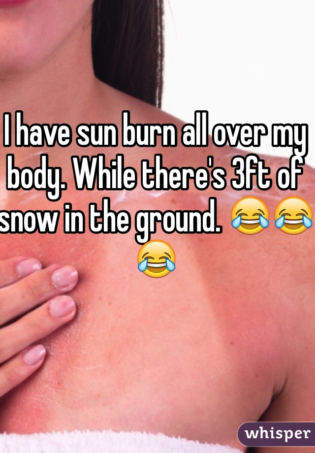 I have sun burn all over my body. While there's 3ft of snow in the ground. 😂😂😂
