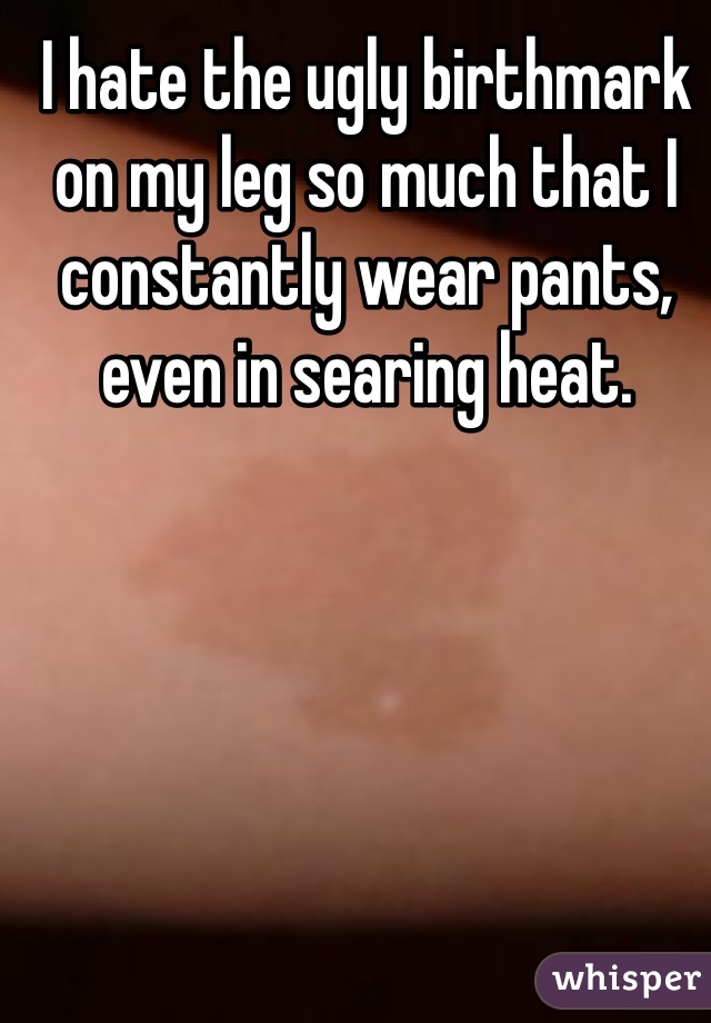 I hate the ugly birthmark on my leg so much that I constantly wear pants, even in searing heat.