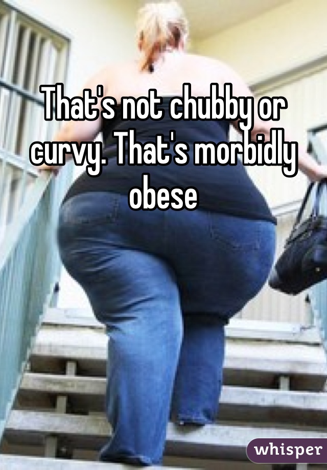 That's not chubby or curvy. That's morbidly obese