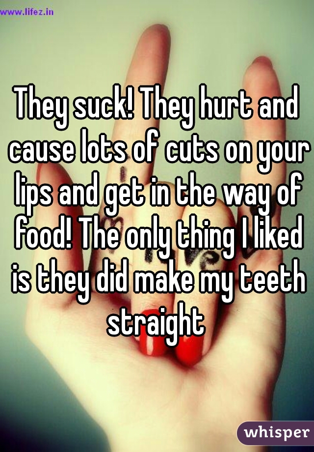 They suck! They hurt and cause lots of cuts on your lips and get in the way of food! The only thing I liked is they did make my teeth straight 