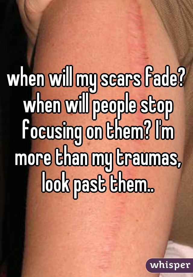 when will my scars fade? when will people stop focusing on them? I'm more than my traumas, look past them..