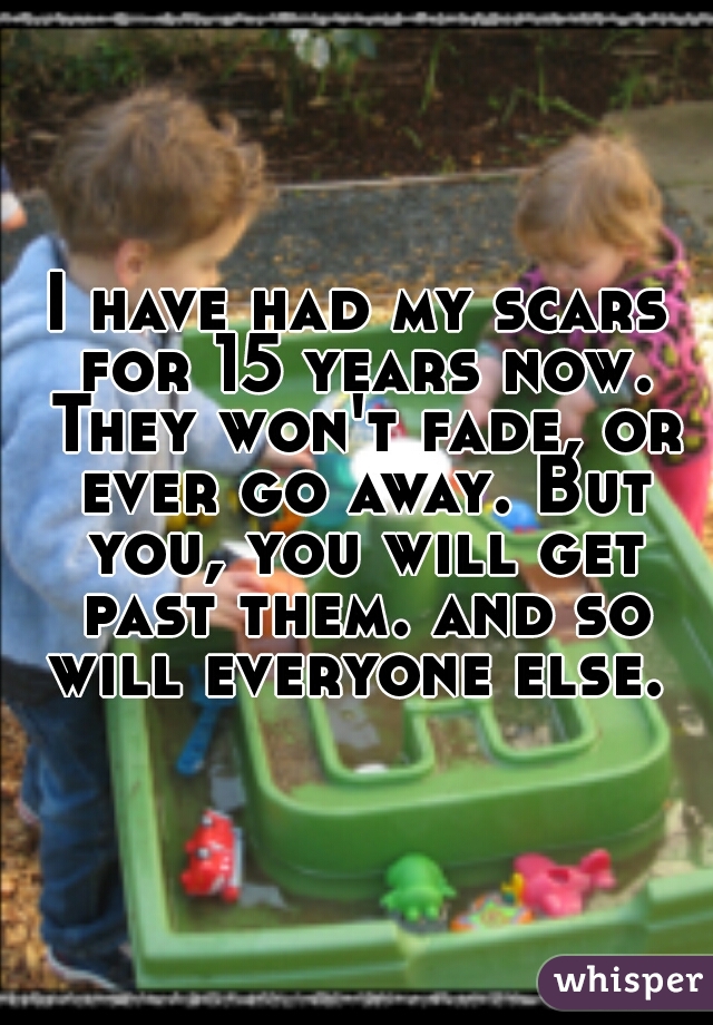 I have had my scars for 15 years now. They won't fade, or ever go away. But you, you will get past them. and so will everyone else. 