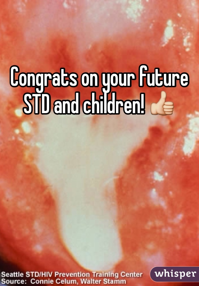 Congrats on your future STD and children! 👍