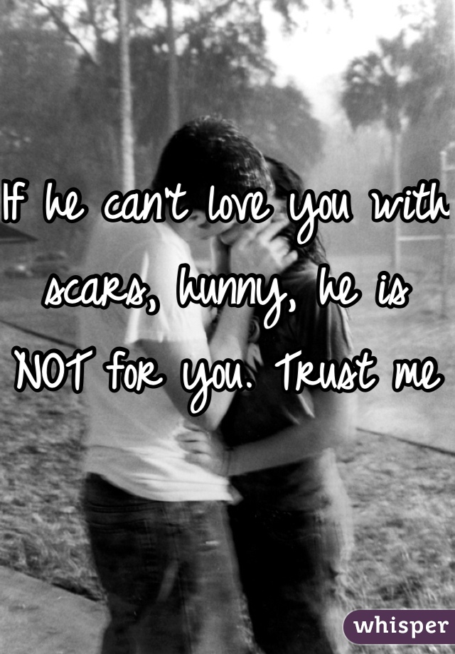 If he can't love you with scars, hunny, he is NOT for you. Trust me 
