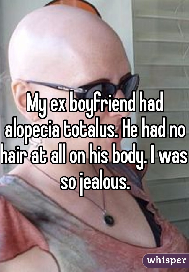 My ex boyfriend had alopecia totalus. He had no hair at all on his body. I was so jealous.