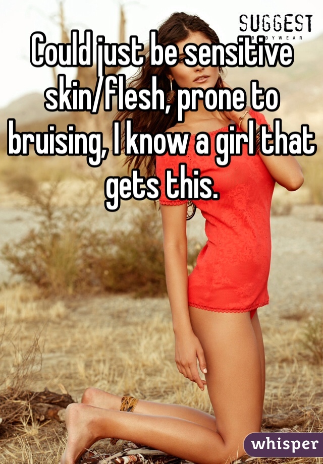 Could just be sensitive skin/flesh, prone to bruising, I know a girl that gets this. 