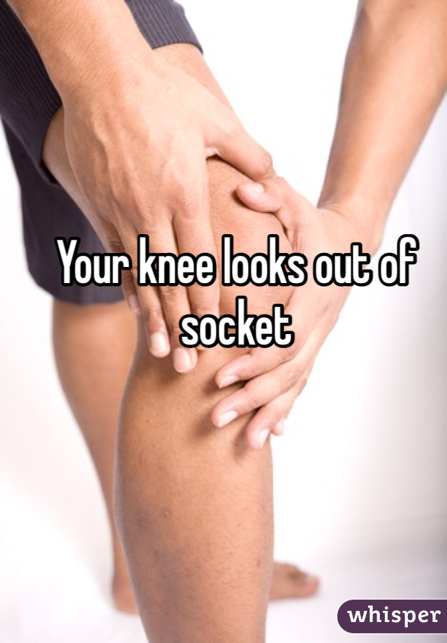 Your knee looks out of socket 