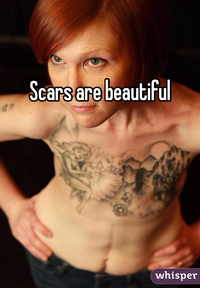 Scars are beautiful