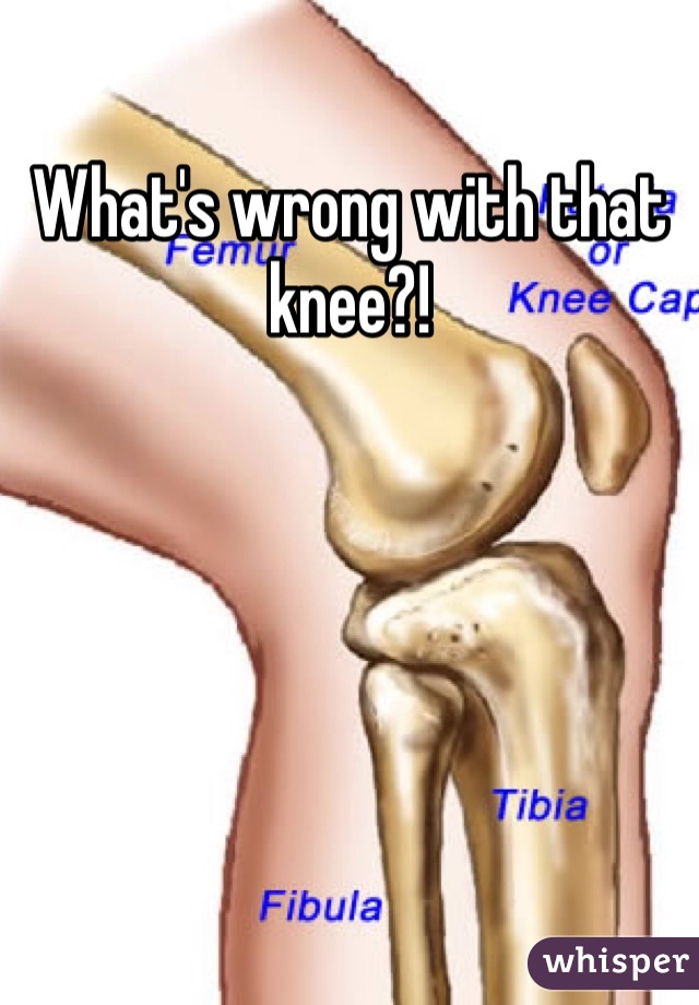 What's wrong with that knee?! 