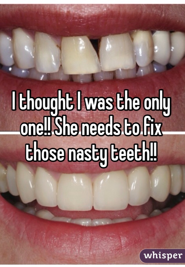 I thought I was the only one!! She needs to fix those nasty teeth!! 