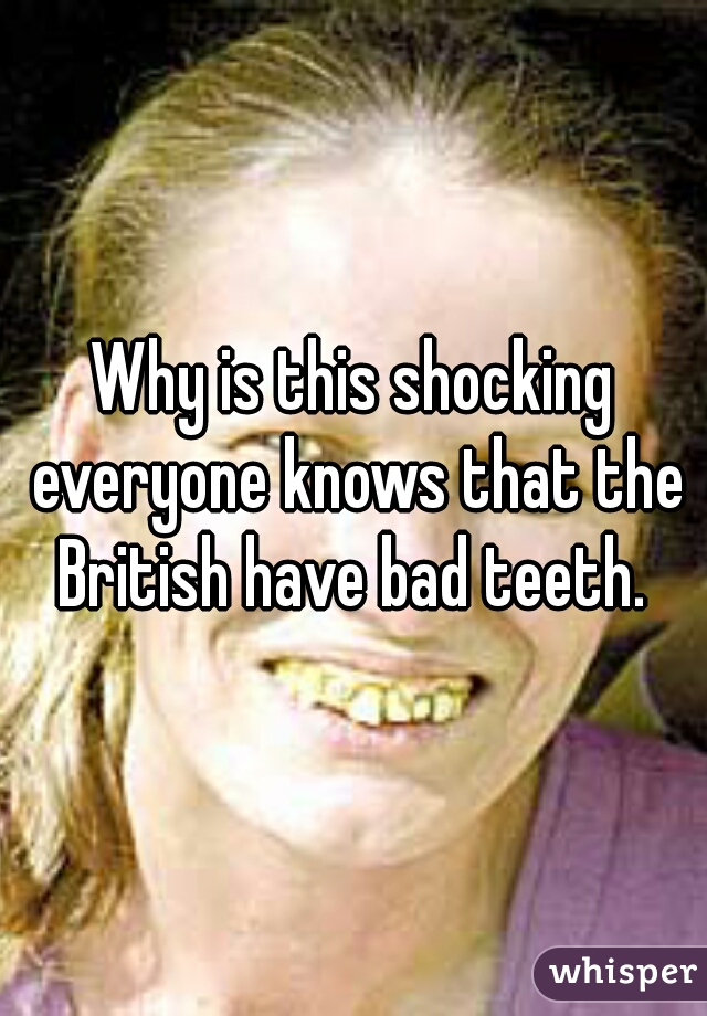 Why is this shocking everyone knows that the British have bad teeth. 