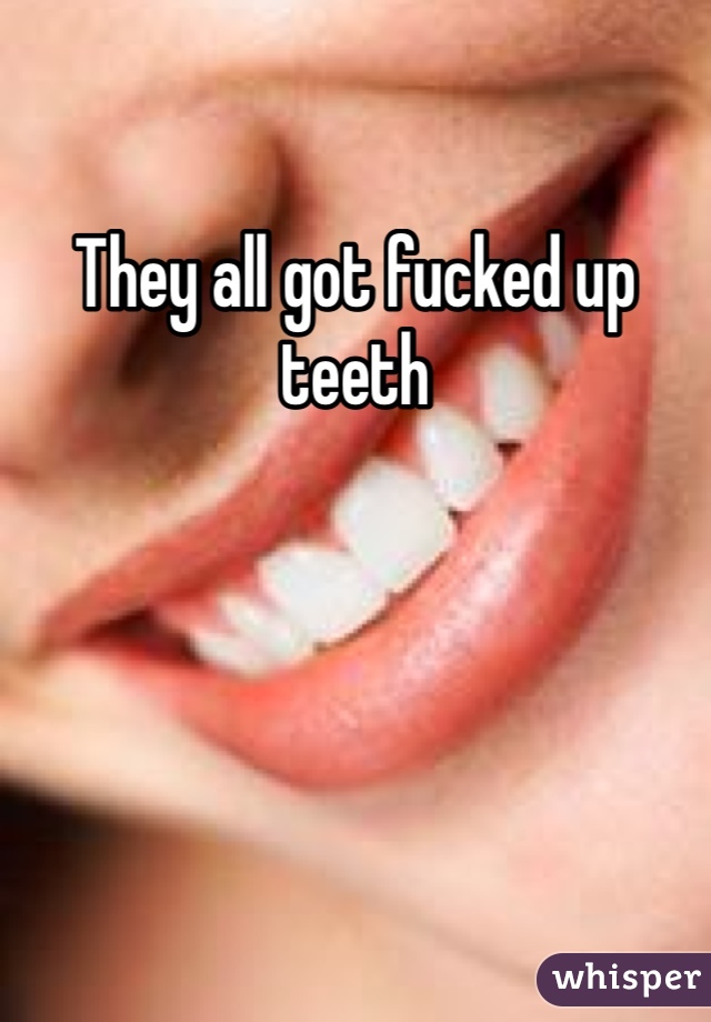 They all got fucked up teeth 