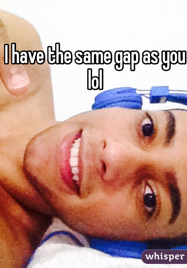 I have the same gap as you lol