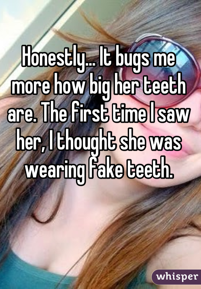 Honestly... It bugs me more how big her teeth are. The first time I saw her, I thought she was wearing fake teeth.