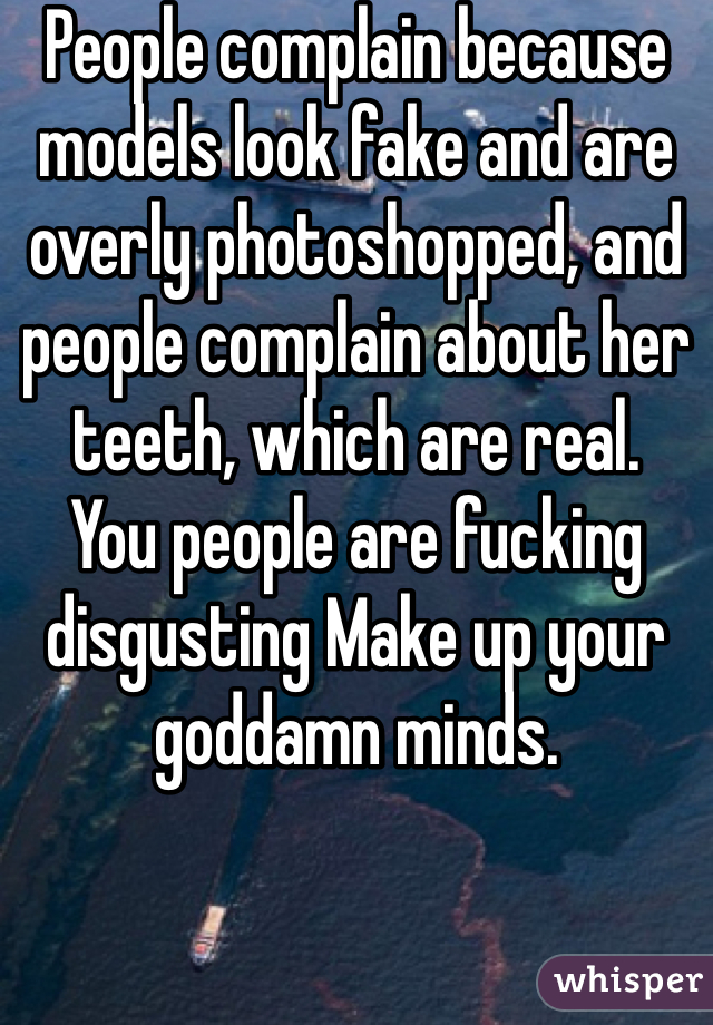 People complain because models look fake and are overly photoshopped, and people complain about her teeth, which are real. 
You people are fucking disgusting Make up your goddamn minds. 