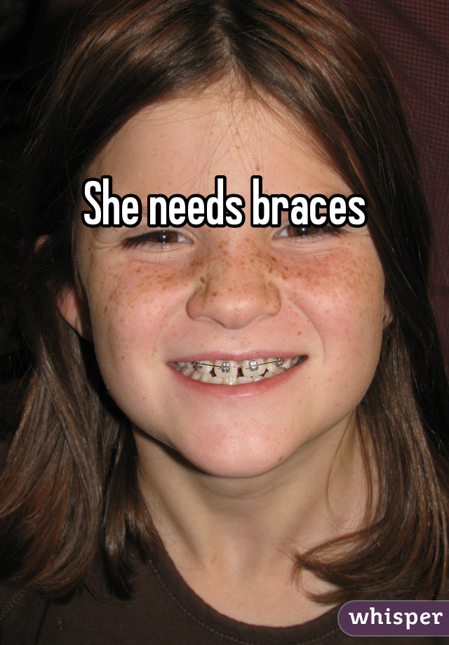 She needs braces
