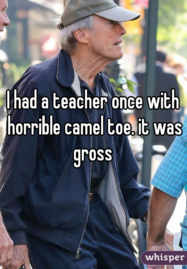 I had a teacher once with horrible camel toe. it was gross 