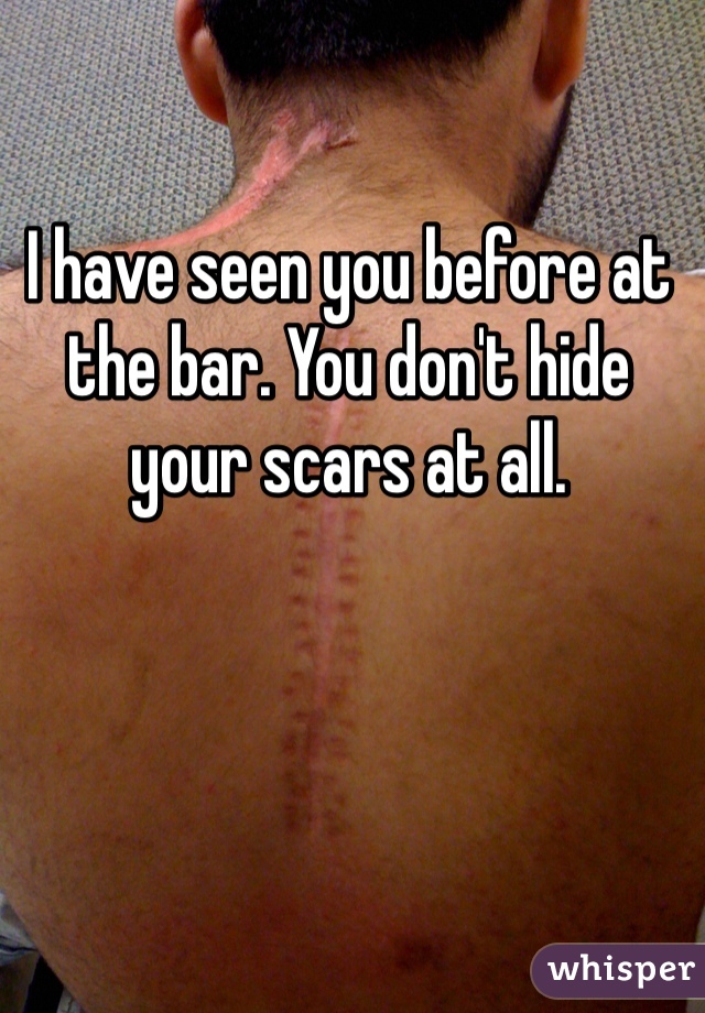 I have seen you before at the bar. You don't hide your scars at all. 