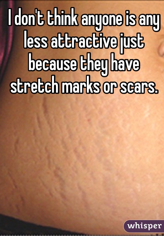 I don't think anyone is any less attractive just because they have stretch marks or scars. 