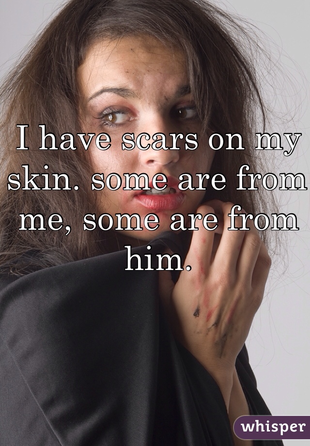 I have scars on my skin. some are from me, some are from him.