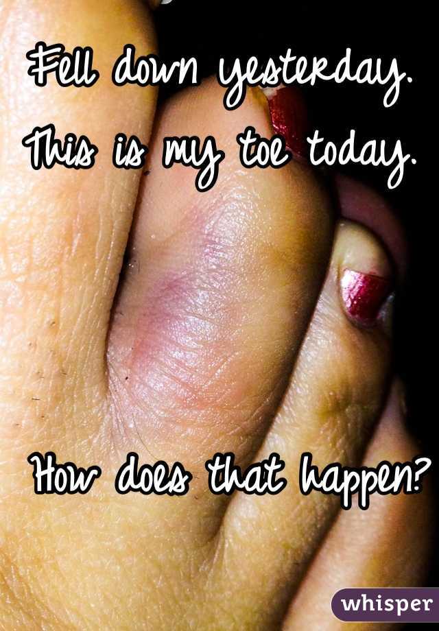 Fell down yesterday. 
This is my toe today.



 How does that happen?