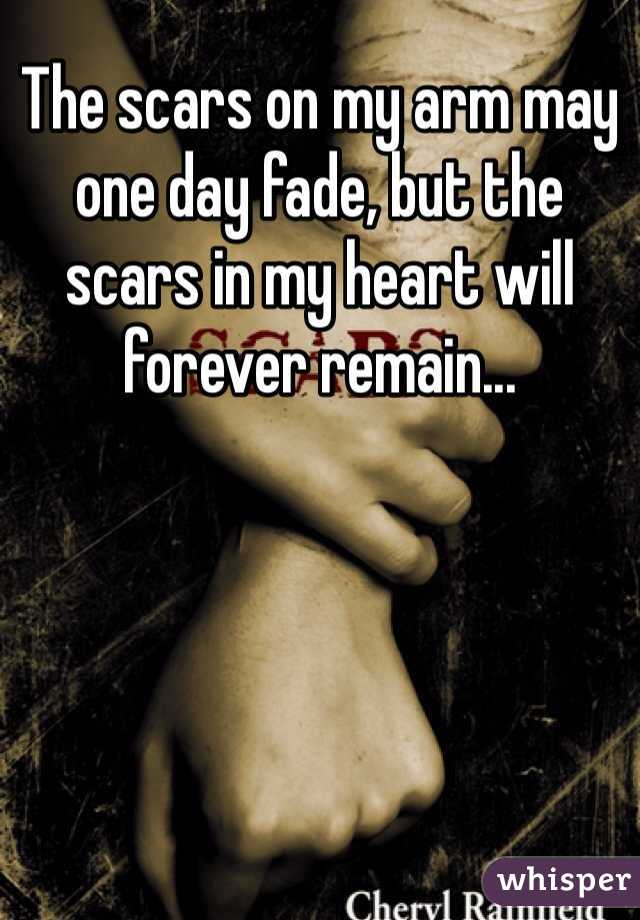 The scars on my arm may one day fade, but the scars in my heart will forever remain...