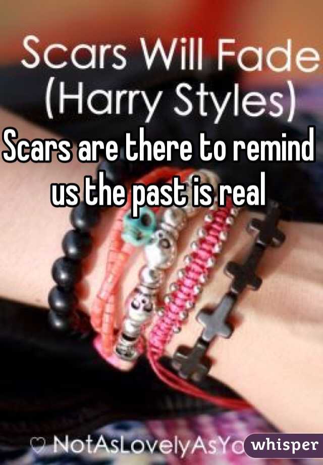 Scars are there to remind us the past is real 