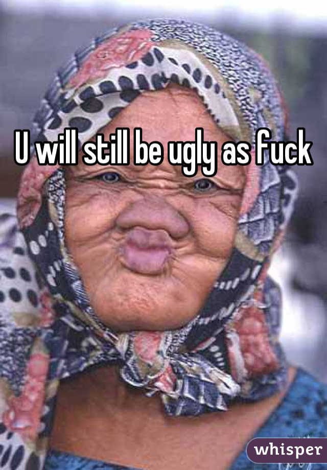 U will still be ugly as fuck