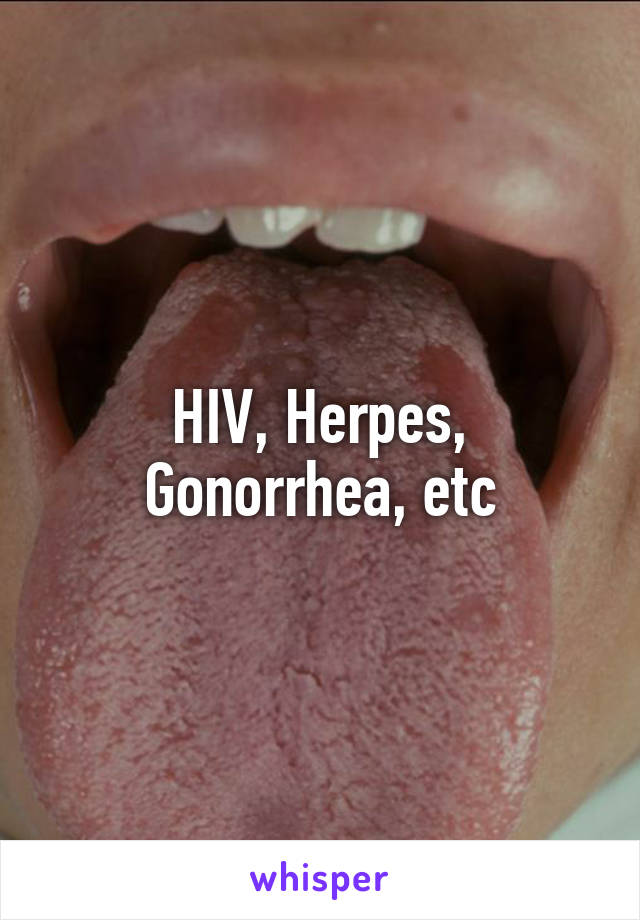 HIV, Herpes, Gonorrhea, etc