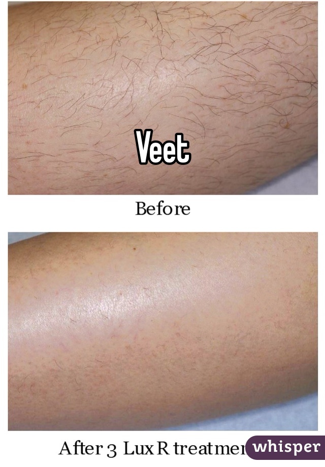 Veet